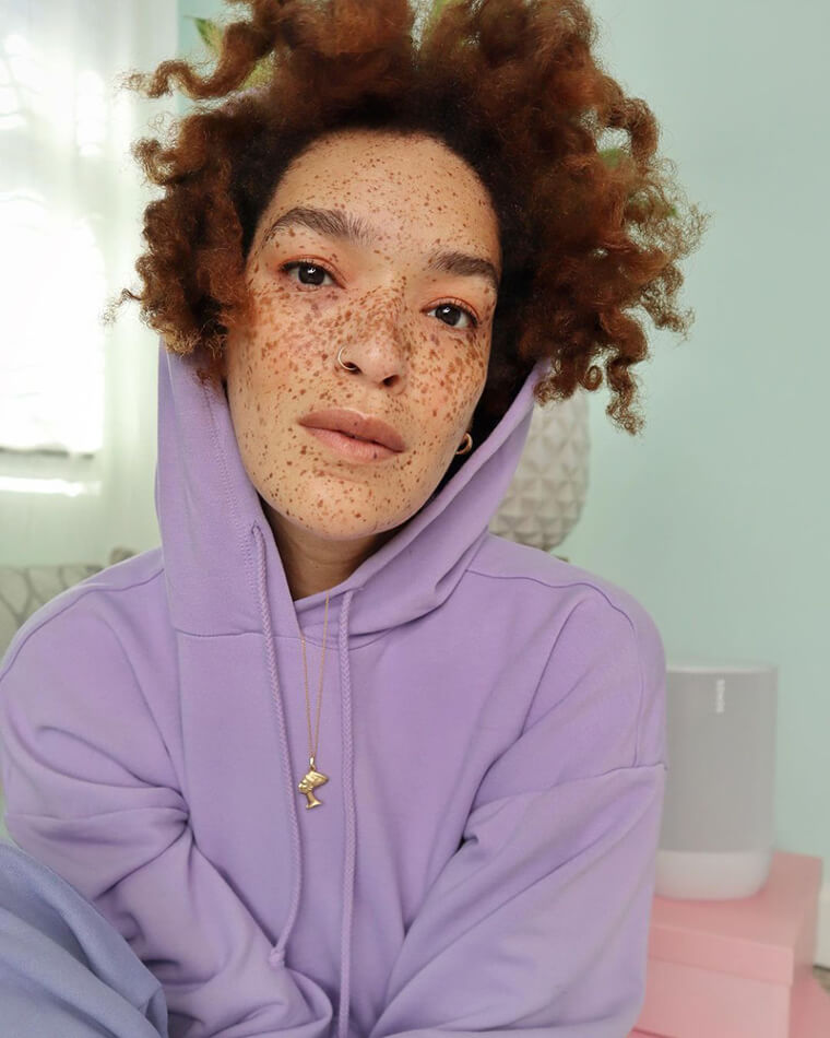 Celebrating Freckles, Gaps, and Unfiltered Faces