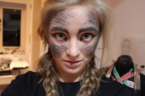 Do You Think You Have Dragon Scales on Your Skin