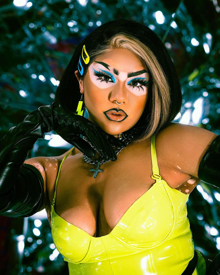 The Power of Vitiligo Skin That Tells a Story